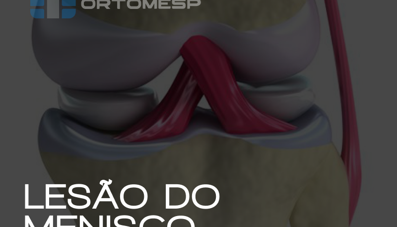 Lesão do Menisco